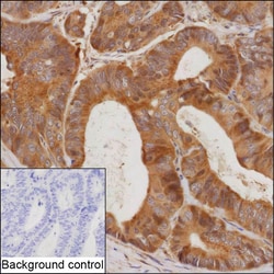 Invitrogen SIRT2 Recombinant Rabbit Monoclonal Antibody (K01_1Y41) 50 &mu;L | Buy Online | Invitrogen&trade; | Fisher Scientific