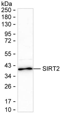 Invitrogen SIRT2 Recombinant Rabbit Monoclonal Antibody (K01_1Y41) 50 &mu;L | Buy Online | Invitrogen&trade; | Fisher Scientific