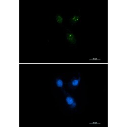 Invitrogen Presenilin 1 Recombinant Rabbit Monoclonal Antibody (K01_3L61) 50 &mu;L | Buy Online | Invitrogen&trade; | Fisher Scientific