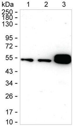 Invitrogen CaMKII alpha Recombinant Rabbit Monoclonal Antibody (K01_1N81) 100 &mu;L | Buy Online | Invitrogen&trade; | Fisher Scientific