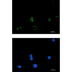 Invitrogen PTGDS Recombinant Rabbit Monoclonal Antibody (K01_1X14) 50 &mu;L | Buy Online | Invitrogen&trade; | Fisher Scientific