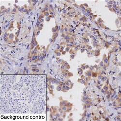 Invitrogen PTGDS Recombinant Rabbit Monoclonal Antibody (K01_1X14) 50 &mu;L | Buy Online | Invitrogen&trade; | Fisher Scientific