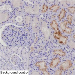 Invitrogen IGFBP6 Recombinant Rabbit Monoclonal Antibody (K03_1J88) 50 &mu;L | Buy Online | Invitrogen&trade; | Fisher Scientific