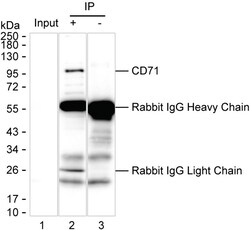 Invitrogen Transferrin Receptor Recombinant Rabbit Monoclonal Antibody (K03_1J02) 100 &mu;L | Buy Online | Invitrogen&trade; | Fisher Scientific