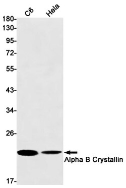 Invitrogen CRYAB Recombinant Rabbit Monoclonal Antibody (K01_1M64) 50 &mu;L | Buy Online | Invitrogen&trade; | Fisher Scientific