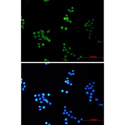 Invitrogen COPS8 Recombinant Rabbit Monoclonal Antibody (K01_1K77) 50 &mu;L | Buy Online | Invitrogen&trade; | Fisher Scientific