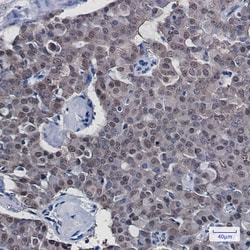 Invitrogen COPS8 Recombinant Rabbit Monoclonal Antibody (K01_1K77) 50 &mu;L | Buy Online | Invitrogen&trade; | Fisher Scientific