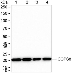 Invitrogen COPS8 Recombinant Rabbit Monoclonal Antibody (K01_1K77) 50 &mu;L | Buy Online | Invitrogen&trade; | Fisher Scientific