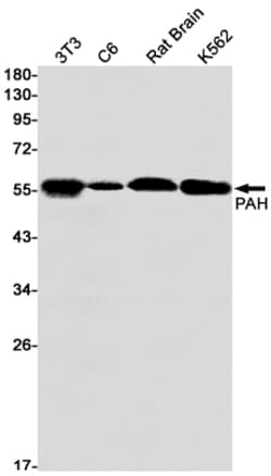 Invitrogen PAH Recombinant Rabbit Monoclonal Antibody (K01_1K84) 100 &mu;L | Buy Online | Invitrogen&trade; | Fisher Scientific