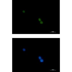 Invitrogen POLD1 Recombinant Rabbit Monoclonal Antibody (K01_1K93) 50 &mu;L | Buy Online | Invitrogen&trade; | Fisher Scientific