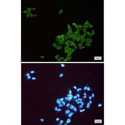 Invitrogen&trade;&nbsp;ENO1 Recombinant Rabbit Monoclonal Antibody (K01_1M06)