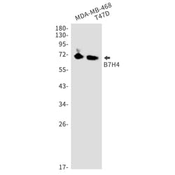 Invitrogen B7-H4 Recombinant Rabbit Monoclonal Antibody (K01_1N36) 100 &mu;L | Buy Online | Invitrogen&trade; | Fisher Scientific