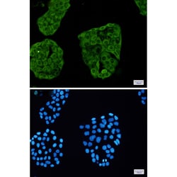 Invitrogen&trade;&nbsp;Annexin A6 Recombinant Rabbit Monoclonal Antibody (K01_1M79)