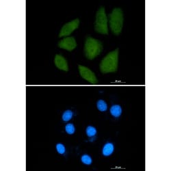 Invitrogen Importin 9 Recombinant Rabbit Monoclonal Antibody (K01_1K59) 50 &mu;L | Buy Online | Invitrogen&trade; | Fisher Scientific