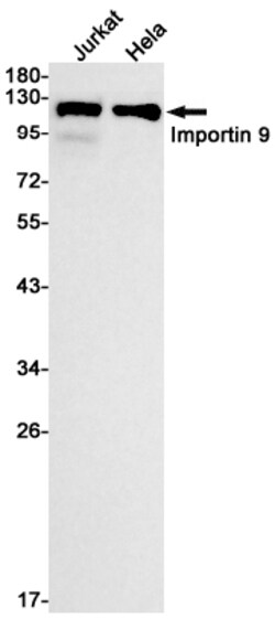 Invitrogen Importin 9 Recombinant Rabbit Monoclonal Antibody (K01_1K59) 50 &mu;L | Buy Online | Invitrogen&trade; | Fisher Scientific