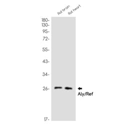 Invitrogen ALY Recombinant Rabbit Monoclonal Antibody (K01_1M69) 50 &mu;L | Buy Online | Invitrogen&trade; | Fisher Scientific