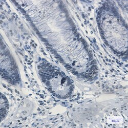 Invitrogen MATR3 Recombinant Rabbit Monoclonal Antibody (K01_1K40) 100 &mu;L | Buy Online | Invitrogen&trade; | Fisher Scientific