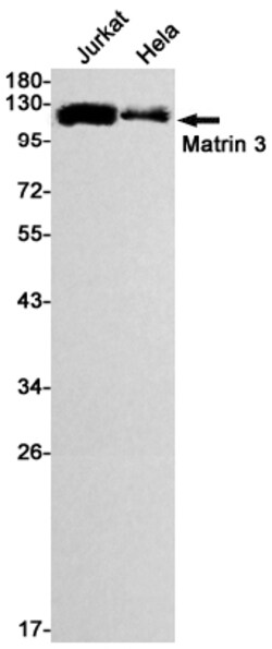 Invitrogen MATR3 Recombinant Rabbit Monoclonal Antibody (K01_1K40) 100 &mu;L | Buy Online | Invitrogen&trade; | Fisher Scientific