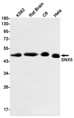 Invitrogen SNX5 Recombinant Rabbit Monoclonal Antibody (K01_1K91) 50 &mu;L | Buy Online | Invitrogen&trade; | Fisher Scientific