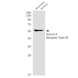 Invitrogen ACVR1B Recombinant Rabbit Monoclonal Antibody (K01_1M35) 50 &mu;L | Buy Online | Invitrogen&trade; | Fisher Scientific