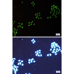 Invitrogen NAT10 Recombinant Rabbit Monoclonal Antibody (K01_1K48) 50 &mu;L | Buy Online | Invitrogen&trade; | Fisher Scientific