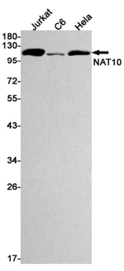 Invitrogen NAT10 Recombinant Rabbit Monoclonal Antibody (K01_1K48) 50 &mu;L | Buy Online | Invitrogen&trade; | Fisher Scientific