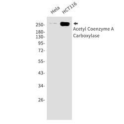 Invitrogen ACACB Recombinant Rabbit Monoclonal Antibody (K01_1M31) 100 &mu;L | Buy Online | Invitrogen&trade; | Fisher Scientific