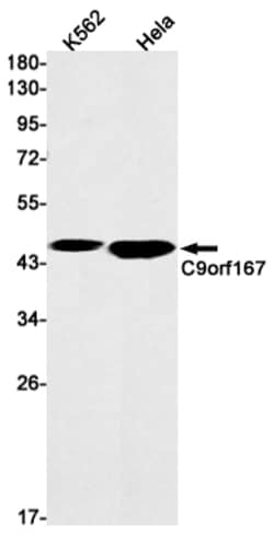 Invitrogen TOR4A Recombinant Rabbit Monoclonal Antibody (K01_1N76) 50 &mu;L | Buy Online | Invitrogen&trade; | Fisher Scientific