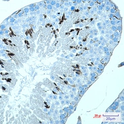 Invitrogen MAGEC2 Recombinant Rabbit Monoclonal Antibody (K01_1L17) 50 &mu;L | Buy Online | Invitrogen&trade; | Fisher Scientific