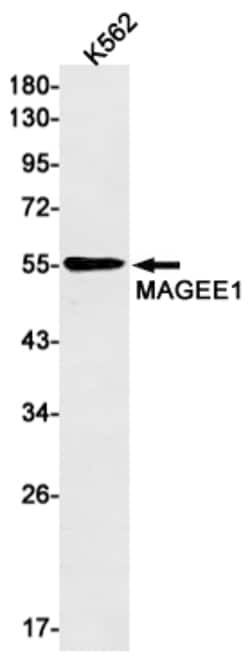 Invitrogen MAGEC2 Recombinant Rabbit Monoclonal Antibody (K01_1L17) 50 &mu;L | Buy Online | Invitrogen&trade; | Fisher Scientific