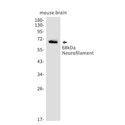 Invitrogen NF-L Recombinant Rabbit Monoclonal Antibody (K01_1M24) 100 &mu;L | Buy Online | Invitrogen&trade; | Fisher Scientific