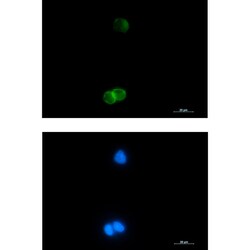 Invitrogen GYPC Recombinant Rabbit Monoclonal Antibody (K01_1L15) 50 &mu;L;