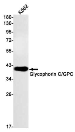 Invitrogen GYPC Recombinant Rabbit Monoclonal Antibody (K01_1L15) 50 &mu;L;