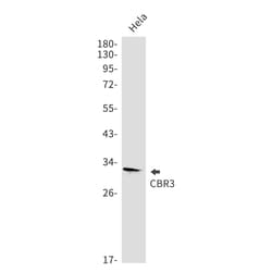 Invitrogen&trade;&nbsp;CBR3 Recombinant Rabbit Monoclonal Antibody (K01_1P02)