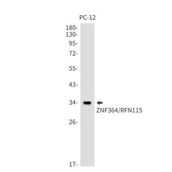 Invitrogen RNF115 Recombinant Rabbit Monoclonal Antibody (K01_1K42) 100 &mu;L | Buy Online | Invitrogen&trade; | Fisher Scientific
