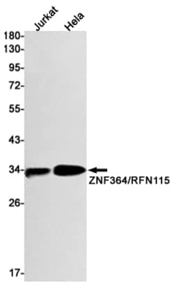 Invitrogen RNF115 Recombinant Rabbit Monoclonal Antibody (K01_1K42) 100 &mu;L | Buy Online | Invitrogen&trade; | Fisher Scientific