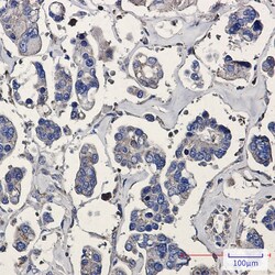 Invitrogen ARPC5 Recombinant Rabbit Monoclonal Antibody (K01_1L59) 100 &mu;L | Buy Online | Invitrogen&trade; | Fisher Scientific