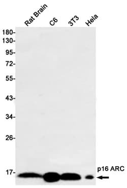 Invitrogen ARPC5 Recombinant Rabbit Monoclonal Antibody (K01_1L59) 100 &mu;L | Buy Online | Invitrogen&trade; | Fisher Scientific