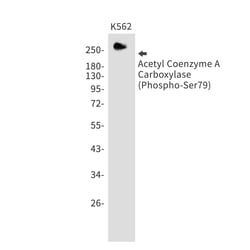 Invitrogen Phospho-Acetyl-CoA Carboxylase (Ser79) Recombinant Rabbit Monoclonal Antibody (K01_1M30) 50 &mu;L | Buy Online | Invitrogen&trade; | Fisher Scientific