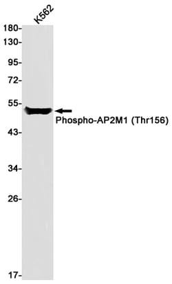 Invitrogen Phospho-AP2M1 (Thr156) Recombinant Rabbit Monoclonal Antibody (K01_1M85) 100 &mu;L | Buy Online | Invitrogen&trade; | Fisher Scientific