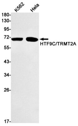 Invitrogen TRMT2A Recombinant Rabbit Monoclonal Antibody (K01_1K72) 50 &mu;L | Buy Online | Invitrogen&trade; | Fisher Scientific