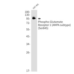 Invitrogen&trade;&nbsp;Phospho-GluR1 (Ser845) Recombinant Rabbit Monoclonal Antibody (K01_1M70)