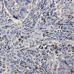 Invitrogen BNIP3L Recombinant Rabbit Monoclonal Antibody (K01_1N61) 50 &mu;L | Buy Online | Invitrogen&trade; | Fisher Scientific