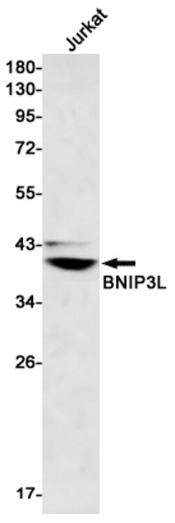 Invitrogen BNIP3L Recombinant Rabbit Monoclonal Antibody (K01_1N61) 50 &mu;L | Buy Online | Invitrogen&trade; | Fisher Scientific