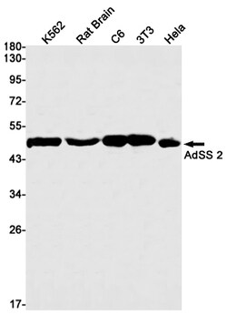 Invitrogen ADSS Recombinant Rabbit Monoclonal Antibody (K01_1M45) 50 &mu;L | Buy Online | Invitrogen&trade; | Fisher Scientific