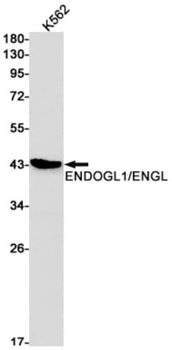 Invitrogen ENDOGL1 Recombinant Rabbit Monoclonal Antibody (K01_1K79) 100 &mu;L | Buy Online | Invitrogen&trade; | Fisher Scientific