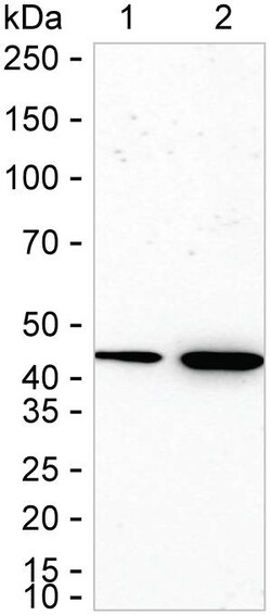 Invitrogen P2Y6 Recombinant Rabbit Monoclonal Antibody (K01_1K82) 50 &mu;L | Buy Online | Invitrogen&trade; | Fisher Scientific