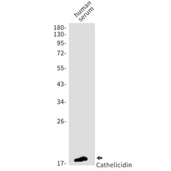 Invitrogen™ Cathelicidin Recombinant Rabbit Monoclonal Antibody (K01_1N95)