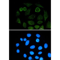 Invitrogen ATF2 Recombinant Rabbit Monoclonal Antibody (K01_1M12) 50 &mu;L | Buy Online | Invitrogen&trade; | Fisher Scientific