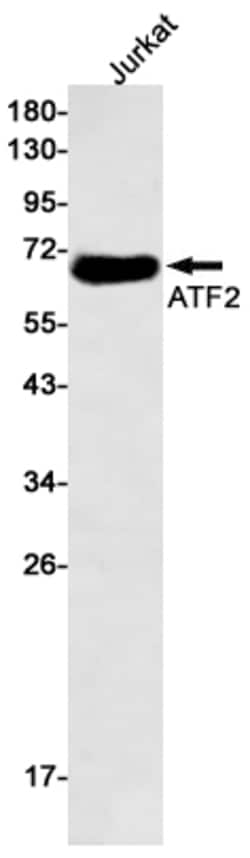 Invitrogen ATF2 Recombinant Rabbit Monoclonal Antibody (K01_1M12) 50 &mu;L | Buy Online | Invitrogen&trade; | Fisher Scientific